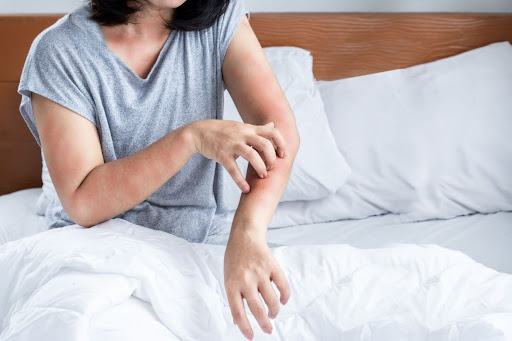 A woman in bed scratching her arm due to a bug bite.